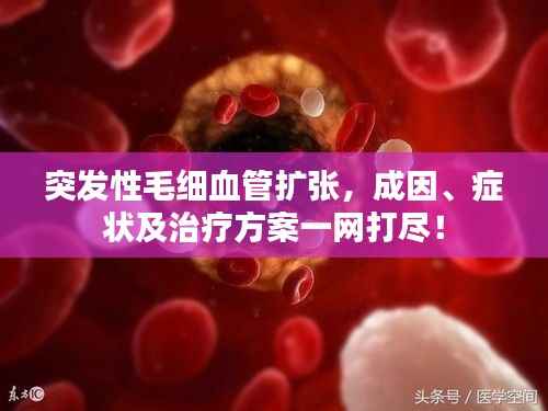 突发性毛细血管扩张,成因、症状及治疗方案一网打尽!