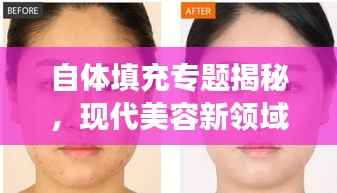 自体填充专题揭秘,现代美容新领域的探索之旅